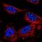 RBM17 antibody, NBP1-81202, Novus Biologicals, Immunocytochemistry image 