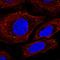 SLC7A11 antibody, HPA064215, Atlas Antibodies, Immunofluorescence image 