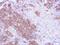 Membrane Palmitoylated Protein 3 antibody, GTX102685, GeneTex, Immunohistochemistry paraffin image 