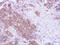 MAGUK p55 subfamily member 3 antibody, GTX102685, GeneTex, Immunohistochemistry paraffin image 