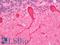 NPHS1 Adhesion Molecule, Nephrin antibody, LS-B12155, Lifespan Biosciences, Immunohistochemistry frozen image 