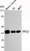 Protein Phosphatase 1 Catalytic Subunit Beta antibody, A04022-1, Boster Biological Technology, Western Blot image 