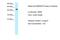 MAPK Activated Protein Kinase 2 antibody, 31-146, ProSci, Western Blot image 