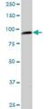 TRNA Methyltransferase 1 Like antibody, H00081627-B01P, Novus Biologicals, Western Blot image 