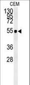 Zic Family Member 3 antibody, LS-C160792, Lifespan Biosciences, Western Blot image 