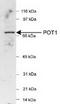 Protection Of Telomeres 1 antibody, TA301520, Origene, Western Blot image 