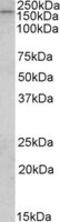 CAP-Gly Domain Containing Linker Protein 1 antibody, MBS422184, MyBioSource, Western Blot image 