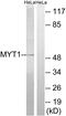 Protein Kinase, Membrane Associated Tyrosine/Threonine 1 antibody, GTX87414, GeneTex, Western Blot image 