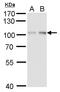 Aryl Hydrocarbon Receptor Nuclear Translocator antibody, GTX128795, GeneTex, Western Blot image 