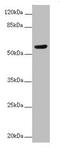 Activin A Receptor Like Type 1 antibody, LS-C677067, Lifespan Biosciences, Western Blot image 