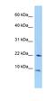 Transcription Elongation Factor A Like 7 antibody, orb325604, Biorbyt, Western Blot image 