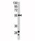 Carbonic Anhydrase 9 antibody, F48970-0.4ML, NSJ Bioreagents, Western Blot image 