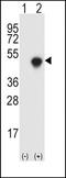Eukaryotic Translation Initiation Factor 4 Gamma 1 antibody, orb256513, Biorbyt, Western Blot image 