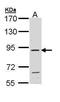 Fibroblast Growth Factor Receptor 4 antibody, PA5-29596, Invitrogen Antibodies, Western Blot image 