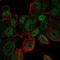 Ubiquitin Conjugating Enzyme E2 V1 antibody, NBP2-57183, Novus Biologicals, Immunofluorescence image 