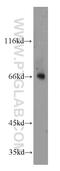 Monooxygenase DBH Like 1 antibody, 11545-1-AP, Proteintech Group, Western Blot image 