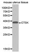 Cathepsin K antibody, LS-C192743, Lifespan Biosciences, Western Blot image 