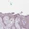 NADH:Ubiquinone Oxidoreductase Subunit A1 antibody, PA5-62951, Invitrogen Antibodies, Immunohistochemistry paraffin image 