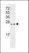 PRL3 antibody, LS-C101020, Lifespan Biosciences, Western Blot image 
