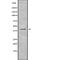 Killer Cell Immunoglobulin Like Receptor, Two Ig Domains And Long Cytoplasmic Tail 5A antibody, abx216464, Abbexa, Western Blot image 