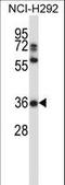 Napsin A Aspartic Peptidase antibody, LS-C164744, Lifespan Biosciences, Western Blot image 