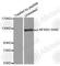 Nuclear Factor Kappa B Subunit 2 antibody, AP0418, ABclonal Technology, Western Blot image 