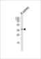 Platelet Derived Growth Factor D antibody, 62-204, ProSci, Western Blot image 