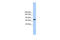 Transmembrane Channel Like 2 antibody, 30-602, ProSci, Western Blot image 