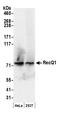 RecQ Like Helicase antibody, A300-450A, Bethyl Labs, Western Blot image 