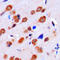 Lemur Tyrosine Kinase 2 antibody, LS-C353326, Lifespan Biosciences, Immunohistochemistry frozen image 
