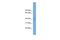 Adrenocortical dysplasia protein antibody, A00985, Boster Biological Technology, Western Blot image 