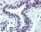 Cyclin Dependent Kinase Like 1 antibody, LS-B6188, Lifespan Biosciences, Immunohistochemistry paraffin image 