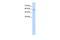 RanBP-type and C3HC4-type zinc finger-containing protein 1 antibody, GTX46933, GeneTex, Western Blot image 