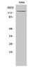 Interferon Induced With Helicase C Domain 1 antibody, STJ94052, St John