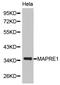 Microtubule Associated Protein RP/EB Family Member 1 antibody, orb136791, Biorbyt, Western Blot image 