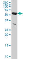 Pyruvate Kinase M1/2 antibody, LS-C197912, Lifespan Biosciences, Western Blot image 