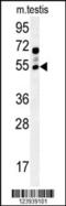 Gamma-Aminobutyric Acid Type A Receptor Gamma2 Subunit antibody, 55-075, ProSci, Western Blot image 