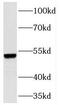 Transmembrane Serine Protease 6 antibody, FNab08808, FineTest, Western Blot image 