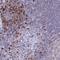 CD25 antibody, NBP2-38730, Novus Biologicals, Immunohistochemistry paraffin image 