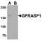 G Protein-Coupled Receptor Associated Sorting Protein 1 antibody, TA349111, Origene, Western Blot image 