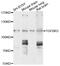 Transforming Growth Factor Beta Receptor 3 antibody, abx135706, Abbexa, Western Blot image 