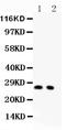 Cyclin Dependent Kinase Inhibitor 1B antibody, PB9070, Boster Biological Technology, Western Blot image 