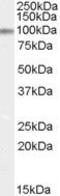 E3 ubiquitin-protein ligase Itchy homolog antibody, PA5-18662, Invitrogen Antibodies, Western Blot image 