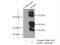 RAR-gamma antibody, 11424-1-AP, Proteintech Group, Immunoprecipitation image 