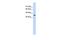 ST6 N-Acetylgalactosaminide Alpha-2,6-Sialyltransferase 5 antibody, GTX45949, GeneTex, Western Blot image 