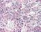 Prolactin Releasing Hormone Receptor antibody, NLS1088, Novus Biologicals, Immunohistochemistry paraffin image 