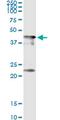 Centromere Protein J antibody, MA5-22212, Invitrogen Antibodies, Immunoprecipitation image 