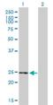 Thioesterase Superfamily Member 5 antibody, H00284486-B01P, Novus Biologicals, Western Blot image 