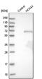 Homeobox A3 antibody, HPA029157, Atlas Antibodies, Western Blot image 