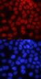 Pygopus Family PHD Finger 2 antibody, MAB3616, R&D Systems, Immunocytochemistry image 